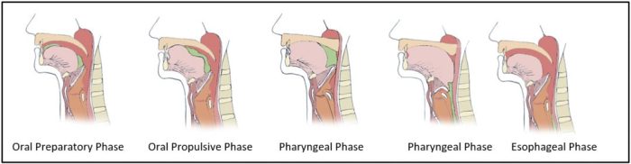 Risk aspiration ncp