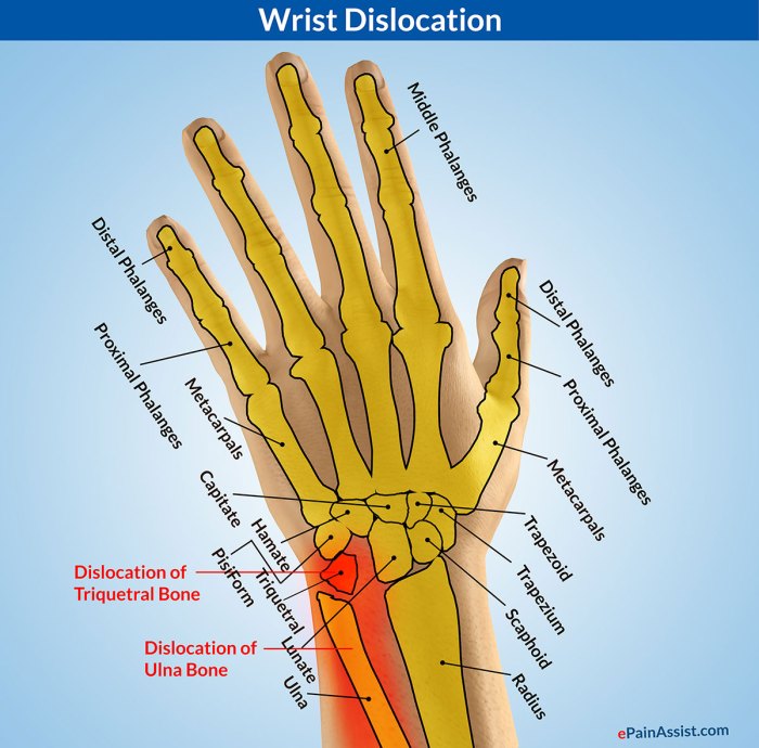 Bone in the wrist crossword