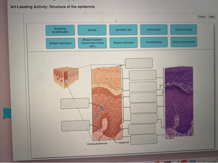 Art-labeling activity: structure of the epidermis