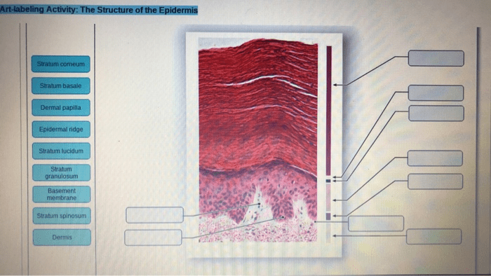 Art-labeling activity: structure of the epidermis